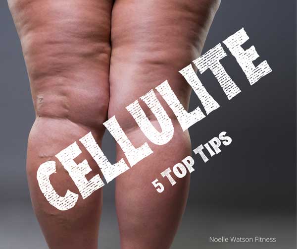 5 Top Tips to Fight Cellulite